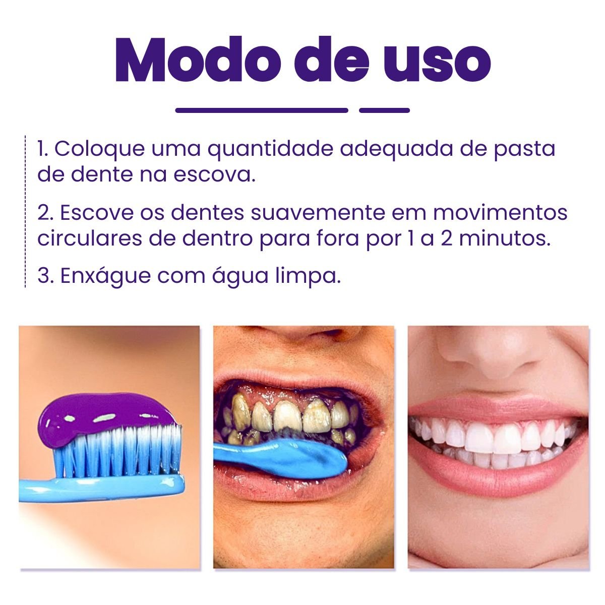 Blanqueador Dental iziSmile - Dientes Blancos en Segundos [Descuento + Entrega Gratis Hoy]