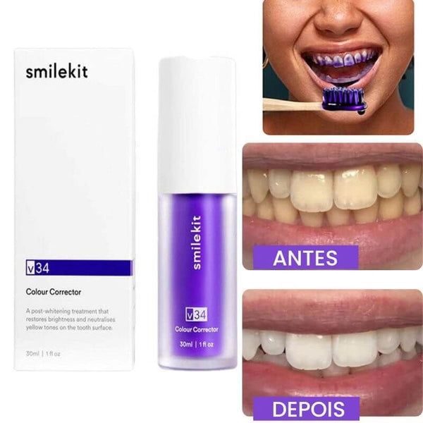 Blanqueador Dental iziSmile - Dientes Blancos en Segundos [Descuento + Entrega Gratis Hoy]