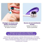 Blanqueador Dental iziSmile - Dientes Blancos en Segundos [Descuento + Entrega Gratis Hoy]