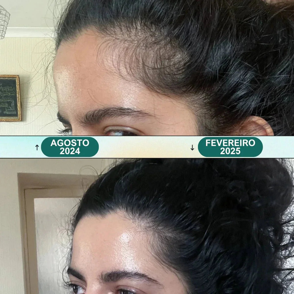 Masajeador Eléctrico - Renova Hair