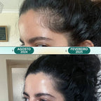 Masajeador Eléctrico - Renova Hair